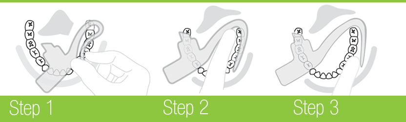 Simple three step insertion process Simple three step insertion process